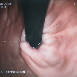 endoscopia (2)